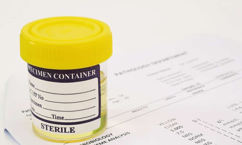 Pred jemanjem antibiotikov morate opraviti urinski test